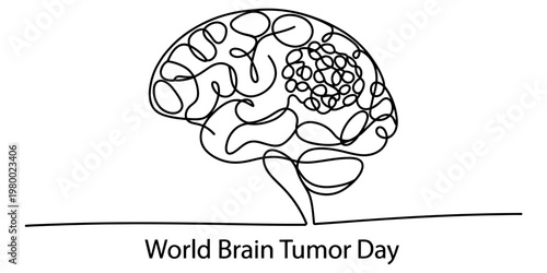 A single continuous line drawing of a human brain featuring a tumor for world brain tumor day. Vector, illustration