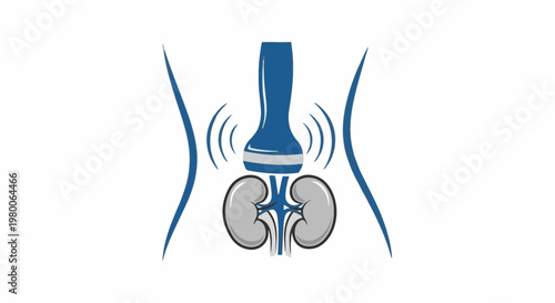 Medical illustration shows ultrasound probe over human kidneys