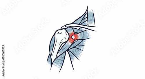Anatomical illustration of a shoulder joint with highlighted inflammation