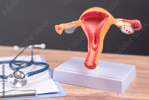 Tableau sur toile the model of the female uterus is on the doctor's table, the gynecologist shows the structure and features of the female internal organs on the model of the female uterus