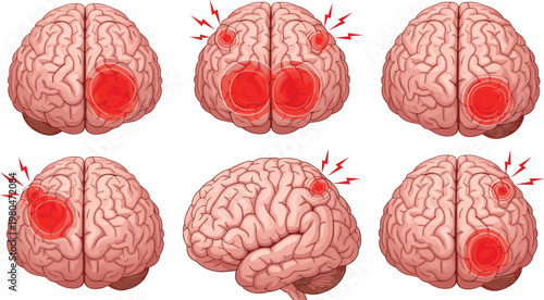Cute Colon Character Illustration Set Showing Different Emotions Including Happy Sad Sick and Pain Expressions in Medical Digestive Health Cartoon Style