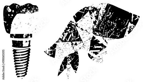 Black and white vector graphic of dental implant and crown, stylized with grunge texture, medical dentistry illustration, isolated tooth prosthetics.