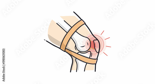 Stylized illustration of a painful knee joint with radiating lines of discomfort