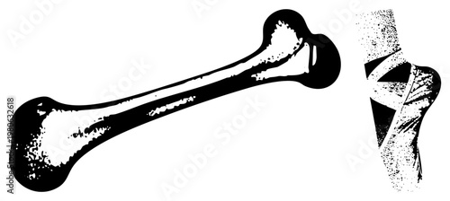 Anatomical bone illustration featuring femur and tibia, stylized with halftone shading and bold, medical or educational vector graphic.