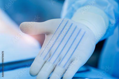 Fotografie Close-up of surgical hand in gloves holding medical mesh suture material in oper
