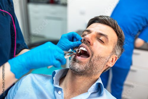 Photography Tooth extraction with pliers