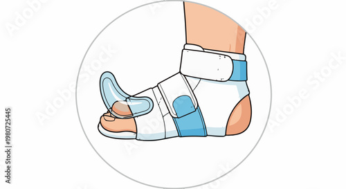 A medical brace supports a foot, stabilizing the ankle and toes