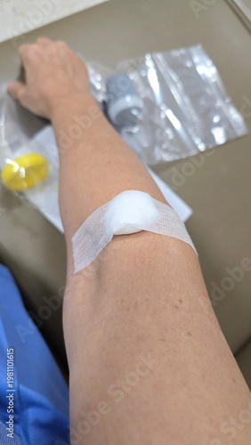 A cotton ball covered with ventilated adhesive tape was placed on the arm, with container for feces and urine on table. Plaster was applied to elbow crease to control bleeding after blood draws, 
