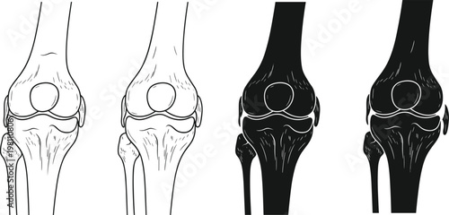 Vector collection of hand drawn anatomical knee joint icons featuring human leg bones patella and femur isolated on white background for medical healthcare design