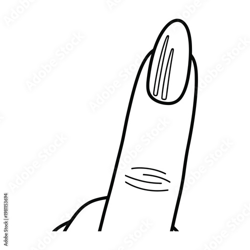 Medical Illustration of Longitudinal Ridging on Human Fingernail Indicating Nail Health Issues