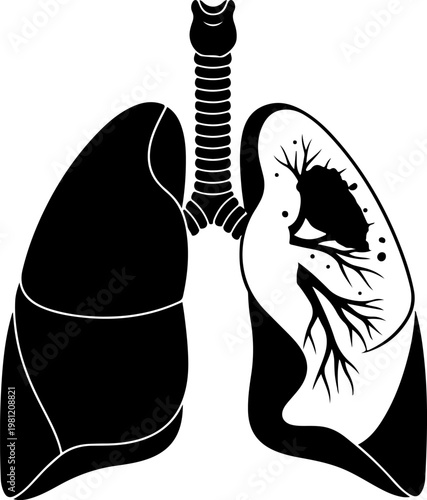 Human lung anatomy silhouette showing respiratory system with trachea and bronchi tubes.
