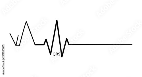 ECG flatline showing cardiac arrest on a heart monitor.