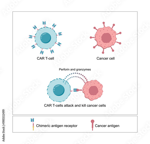 	
CAR T-cell therapy, killing of tumor cells. Cancer therapy. Chimeric antigen receptor T cell ,CAR T cell, for use in immunotherapy. Genetic engineering. Chemotherapy. Vector illustration.