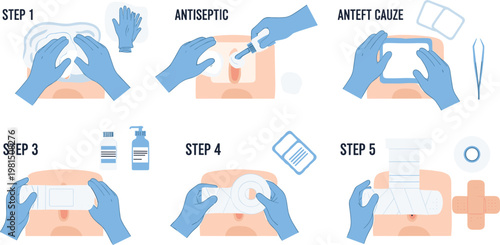 Vector Illustration of First Aid Treatment Steps, Including Antiseptic Application, Bandaging, and Wound Care Process for Healthcare and Emergency Instructions