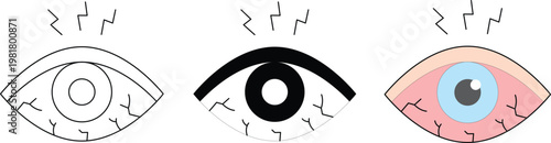 Eye Strain Illustration Set, Tired Dry Eye Symptoms Vector with Pain and Fatigue Concept