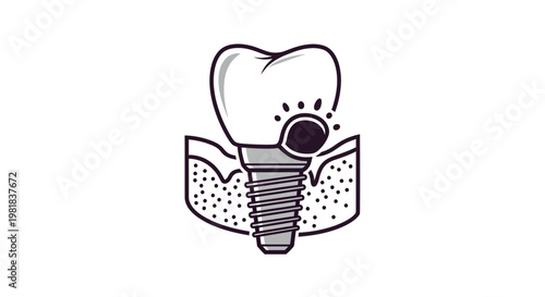 Precision Implants Abstract Outline Icon for Modern Dental Restoration Solutions. transparent.