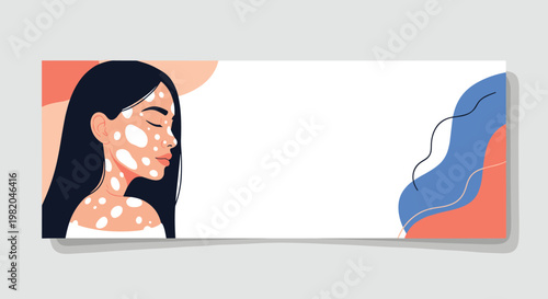 Banner design featuring a beautiful woman with vitiligo on her face and neck over a minimalist abstract background.