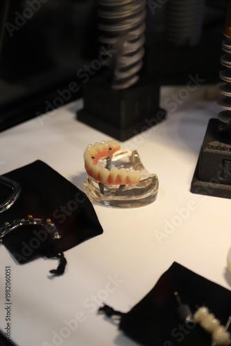 prótesis dental con implantes
