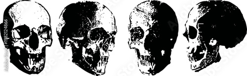 human skull medical illustration showing four different side views with detailed bone structure