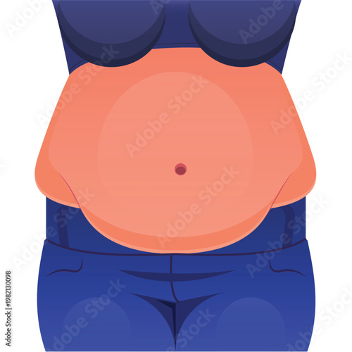 Overweight Fat Belly Illustration, Fat Belly Close Up Illustration, Obesity Awareness Concept