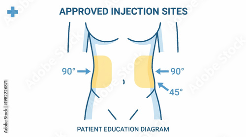 Diagram illustrating approved injection sites on the abdomen for medical procedures, indicating 90 and 45-degree angles.