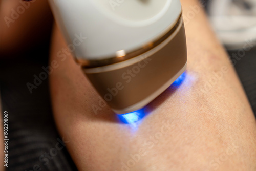 Foto Female hand using IPL laser hair removal device on leg at home