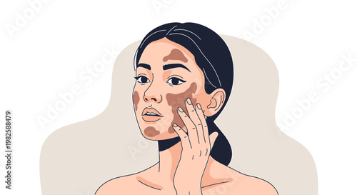Woman with skin pigmentation face illustration