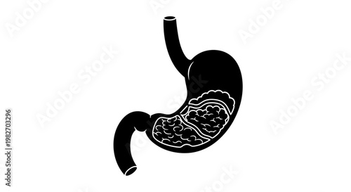 Anatomical illustration of a human stomach with internal structures shown