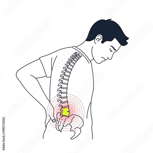 Man with Lower Back Pain, Lumbar Spine Inflammation, Sciatica Symptoms, Medical Illustration