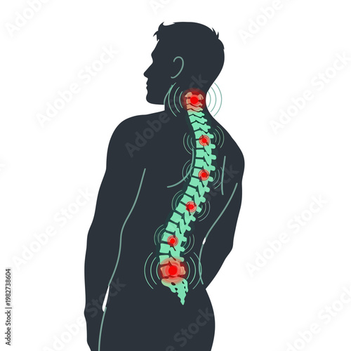 Human spine pain illustration, backache, spinal column health problem, red spots indicating discomfort