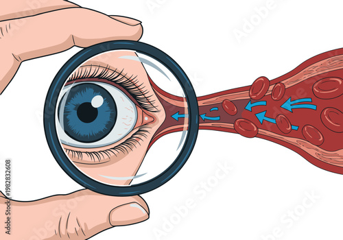 A magnified view reveals microscopic blood flow within a human eye, highlighted by a magnifying glass. Illustrates circulatory system detail.