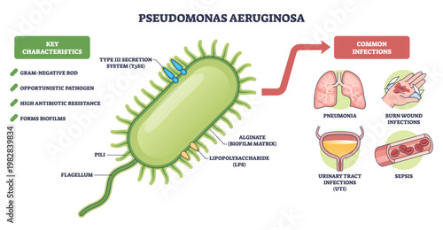 Pseudomonas aeruginosa brief diagram explains this gram negative pathogen and its diseases, focusing on bacterium cell, flagellum, and pili for quick study. Outline diagram