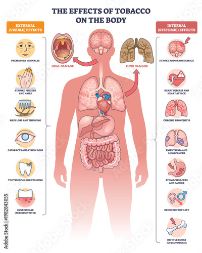 Tobacco effects on the body shown in a brief medical outline, highlighting lungs, heart, and mouth with damage indicators and labeled risks for organs and skin. Outline diagram