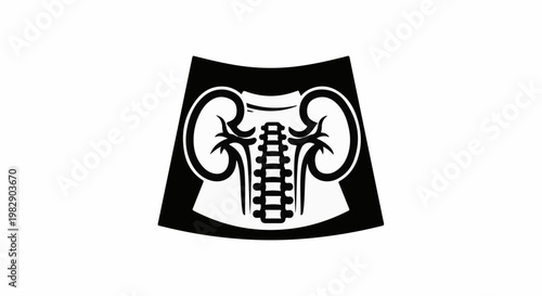Stylized depiction of human kidneys and spine on black background