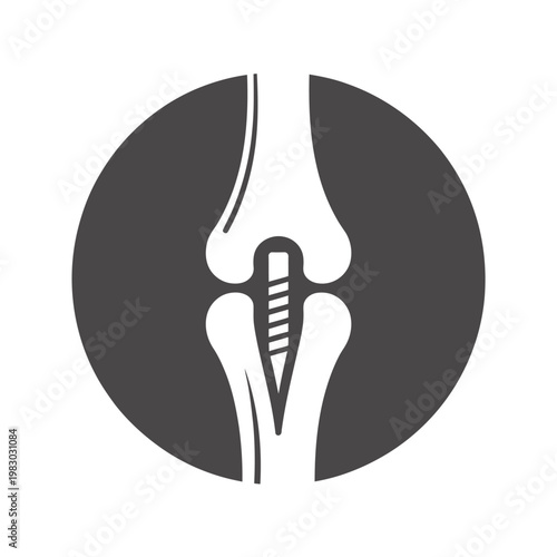 Vector graphic of a knee joint with a screw inside, set against a dark gray circle