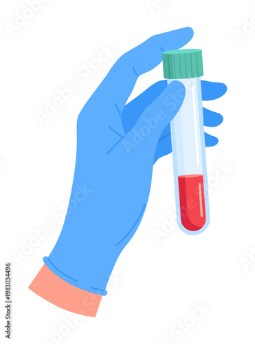 Hand of lab worker wearing medical glove holding blood sample in test tube. Laboratory analysis. Diagnostic examination. Glass flask in doctor arm palm. Bloody
