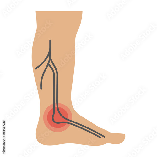 Vector of a human leg with a red spot indicating pain or inflammation near the ankle joint.