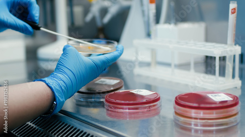 Quadro su tela Laboratory technician in blue gloves uses a sterile tool to transfer samples in