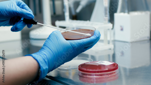Vászonkép Laboratory technician in blue gloves uses a sterile swab to collect a sample fro
