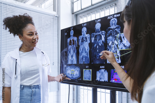 Young diverse female doctor students looking at MRI and CT scans on monitor in hospital office. radiologists meeting to discussing patient cancer surgery at lab. healthcare and medical education.