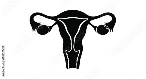 Anatomical illustration of a black uterus with fallopian tubes and ovaries