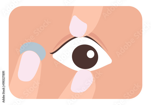 Detailed close up of inserting a contact lens into the eye.