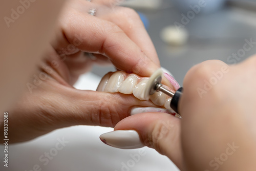 A dental technician meticulously polishes a ceramic prosthesis. Macro shot of hands creating a dental bridge with a specialized tool in a laboratory, highlighting precision and cosmetic dentistry.