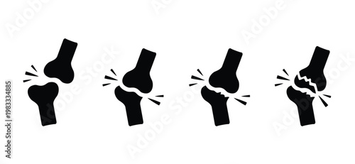 Cartoon knee bones. Bones icon set. Anatomy, human knee bone snatomy concept. Broken knee joint with pain. Bone joints. Science design. Structure of the knee joints. Human leg.