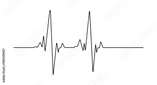 A black electrocardiogram line graph on a white background