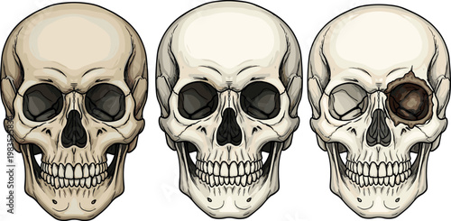 Human skull vector set with different variations including cracked and realistic bone anatomy design isolated on white background