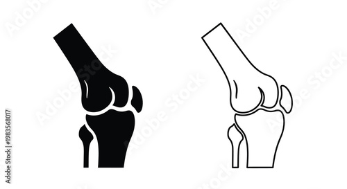 Anatomical illustration depicting a human knee joint in two contrasting views