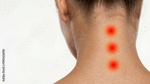Close-up of a person's neck with red pain zones on the spine. Concept of neck pain, cervical strain, inflammation, and medical treatment. White background with copy space for health care design.