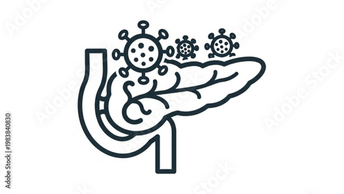 Medical illustration of the pancreas with viruses, representing pancreatic disease and infections