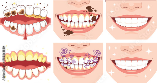 Dental Before and After Treatment Illustration Set with Plaque, Cavities, Braces Cleaning, Whitening, and Healthy Smile Results for Oral Care and Dentistry Design